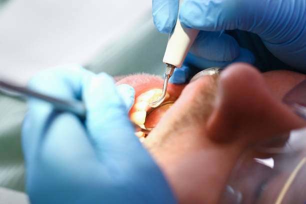 Best Emergency Care for Gum Disease in Mcpherson, KS