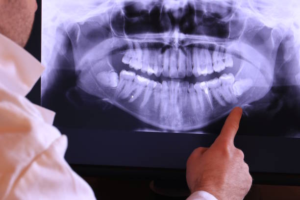 Best Dental Abscess Treatment in Mcpherson, KS