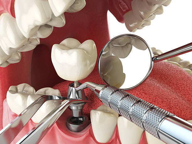 Professional Emergency Dental Service in KS